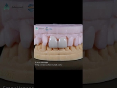 فنیر طبیعی EMAX فشرده شده قدرت 16 رنگ فنیر دندان Emax