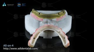 ترمیم دندان پریمیوم چرخش سریع