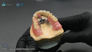 کیفیت لحیم کاری دقیق تاج تلسکوپ