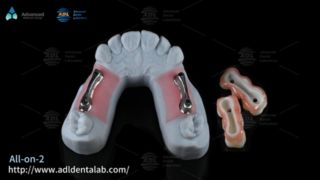 میله ایمپلنت تیتانیوم ممتاز برای دندانپزشکی All On X