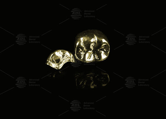 خرید الایو گرانبها طلا زرد 60٪ تاج فلزی کامل طلا تکمیل تاج فلزی کامل تولید آنلاین