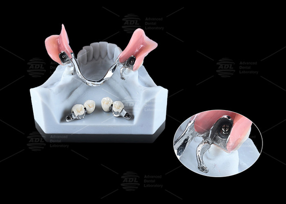 خرید 0.1mm تحمل CEKA REVAX اتصال تیتانیوم 3mm شفافیت عمودی تولید آنلاین