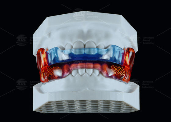 خرید دستگاه ضد خروپف سیلیکونی درجه پزشکی برای بهبود خواب تولید آنلاین