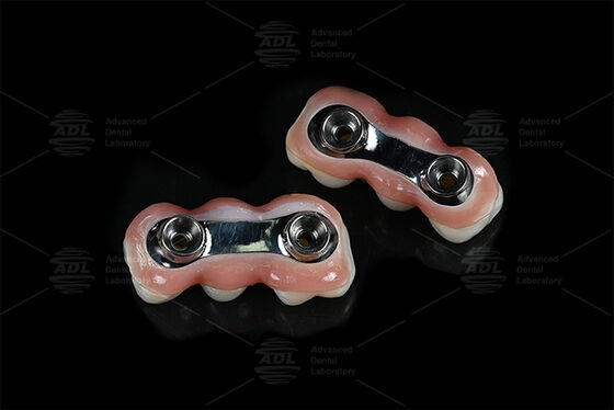 خرید بار ایمپلنت تقویت شده CAD CAM طراحی شده برای مناسب بودن دقیق سازگار با اکثر سیستم های ایمپلنت دندان تضمین راه حل های ترمیم دندان آزمایشگاه دندان چینی تولید آنلاین