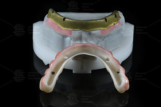 خرید لابراتوار دندانپزشکی چین با اکثر سیستم های ایمپلنت دندان سازگار همه در 4 ارائه در 72 ساعت زمان برگشت و آرایه پارامترهای فنی تولید آنلاین