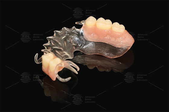 Vertex Clear Flexible Partial تقریبا ناقص خطر آلرژی کم پروتز کامل و جزئی