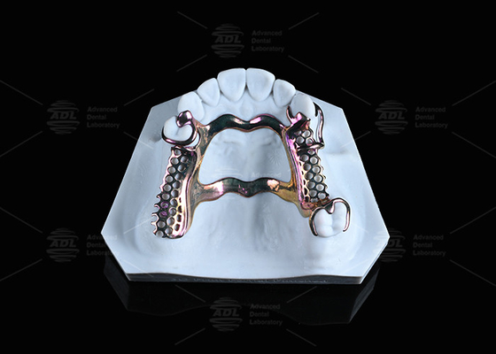 3D چاپ شده
