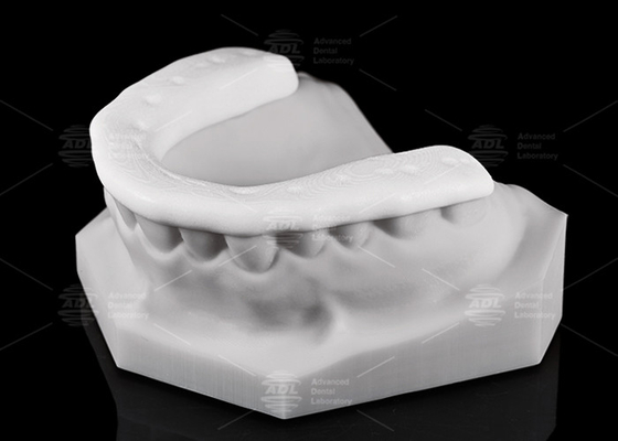 دوام و تنفس پذیری 3D چاپ نایلون Occlusal Splint / Night Guard برای سبک زندگی فعال