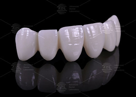 قیمت رقابتی با تخفیف حجم آزمایشگاه دندانپزشکی ارائه 16 رنگ پروتز دندان متناسب با صنعت پزشکی