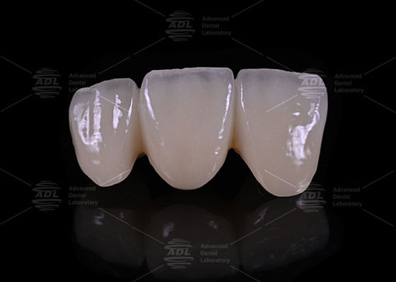 China Dental Lab Accurate Precision Of Margins Layered Zirconia Hypoallergenic Biocompatible Dental Material For Durable And Restorations