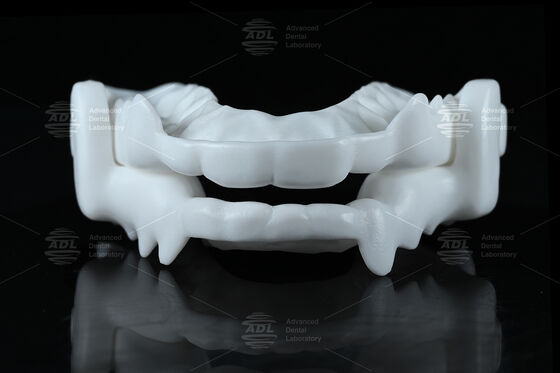 اسپلینت اکلوزال نایلونی درجه پزشکی با طراحی انعطاف‌پذیر CAD/CAM برای محافظت در برابر دندان قروچه
